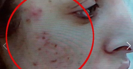 JEZIV PRIZOR, IZBLIZA SNIMLJENO LICE LUNE ĐOGANI: Gledatelji u šoku, stanje ALARMANTNO!