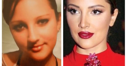 SVI BULJE U OVE FOTOGRAFIJE I NE MOGU DA VJERUJU SVOJIM OČIMA: Pogledajte kako su pjevačica sa estrede izgledale PRIJE I POSLIJE OPERACIJA