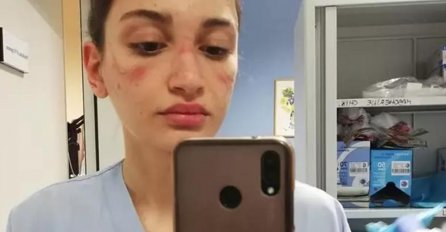 MEDICINSKA SESTRA IZ ITALIJE OBJAVILA ZASTRAŠUJUĆE SLIKE, evo kako izgledaju posljedice KORONE: OVO JE JEZIVO!