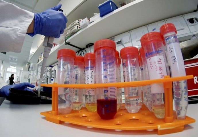 U Hrvatskoj 77 novih slučajeva koronavirusa, 867 ukupno