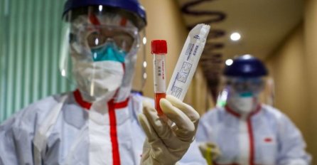 KCUS: Testirano novih 17 uzoraka, četvoro pozitivnih