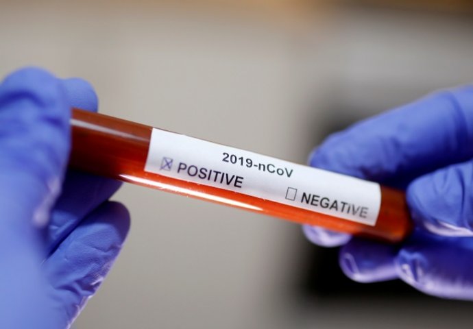 Slovenija uvodi nove mjere u borbi protiv koronavirusa