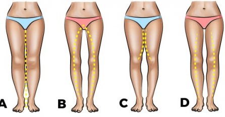 UTRLJALA JE OVO PO BUTINAMA PRIJE SPAVANJA: Ujutro kad je pogledala u svoje noge, MISLILA JE DA SANJA