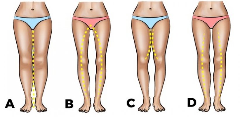 5a63978b-2310-4658-9d02-53390a0a0a67-noge1