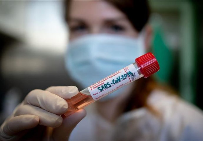 U UKC u Banjoj Luci preminula dva pacijenta od posljedica koronavirusa