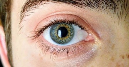 20 ljudi s čijim se fizičkim karakteristikama poigrala GENETIKA, ČEKAJTE DA VIDITE BROJ 9!