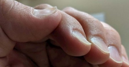 20 ljudi s čijim se fizičkim karakteristikama poigrala genetika, ČEKAJTE DA VIDITE BROJ 8!