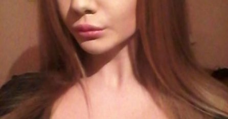 "PUMPALA" JE USNE 20 PUTA, DOKTORI KAŽU DA JE PRETJERALA: Šta vi mislite, pogledajte najnovije slike pa procijenite