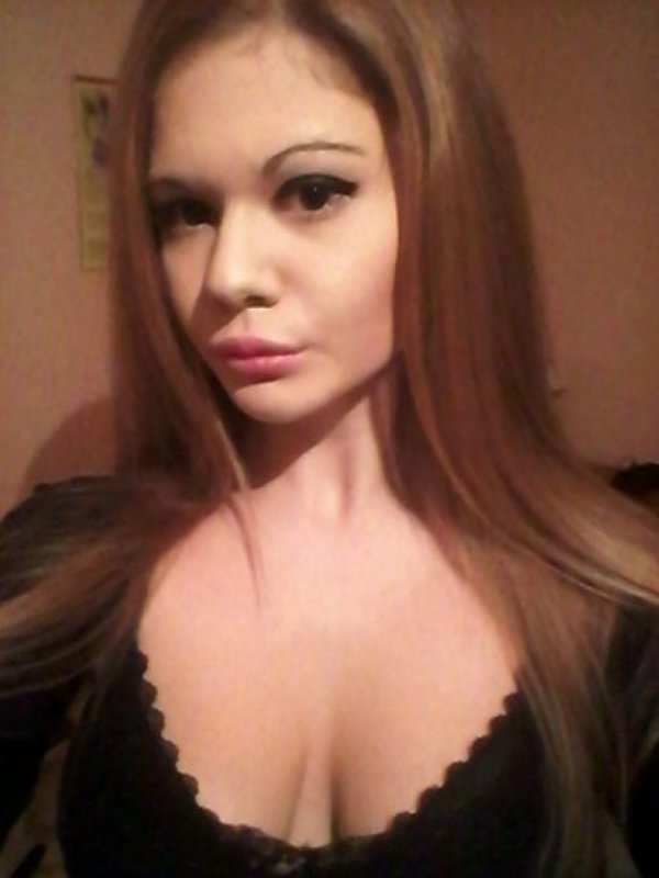 andrea-ivanova-before-injecting-her-lips-image-jam-press-449x598