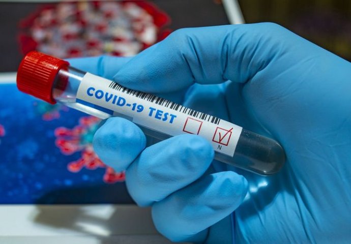U RS još devet zaraženih virusom korona, dvije osobe umrle