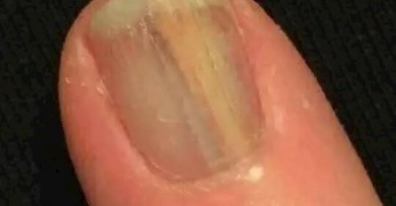 9 užasnih fotografija koje će uznemiriti svaku gadljivu osobu, MOŽETE LI IZDRŽAT DO POSLJEDNJE?