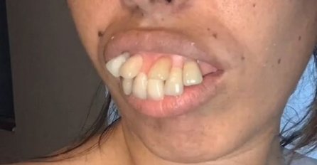 SVIJET JE ŠOKIRALA SVOJIM ZUBIMA, A ONDA SE UDALA ZA ZUBARA: Kad je sada vidite ZAPREPASTIT ĆETE SE, POGLEDAJTE KAKVU "MAGIJU" JE NAPRAVIO (FOTO)