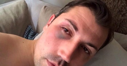 NOVI.BA U POSJEDU NOVIH FOTOGRAFIJA: Pogledajte kako je HARIS PLAKALO izgledao nakon okršaja u kafani (VIDEO)