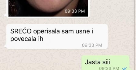 MOJA CURA JE BILA KOD PLASTIČARA, POGLEDAJTE NA ŠTA LIČI: Povećala je usne, SAD JE STVARNO OSTAVLJAM, KRAJ!!