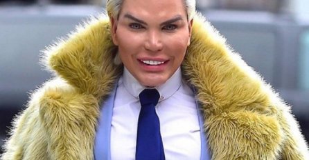 LJUDSKI KEN ODLUČIO DA POSTANE BARBIKA, PREKO 200 OPERACIJA IMAO: Pogledajte kako sad izgleda, ŠOK SLIKA