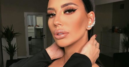 SRPSKA PJEVAČICA IZGREBANA I U OPEKOTINAMA? Objavljena slika, svi zabrinuti za nju (FOTO)