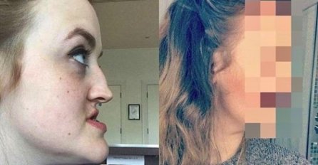 BILA JE RUŽNA, A ONDA JE OTIŠLA KOD PLASTIČARA I SAD JE LJEPOTICA BEZ MANE: Kad joj vidite lice OČARAT ĆE VAS, niko ne može da vjeruje