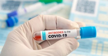 Makedonci tvrde: U Srbiji se prodaju falsifikovani negativni PCR testovi na koronavirus