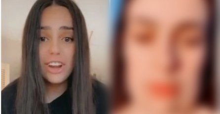 SOFIJA (19) ISISALA SALO IZ LICA, SAD SVA IZOBLIČENA: “Kad me tata vidio, VRISNUO JE” POGLEDAJTE NA ŠTA LIČIM