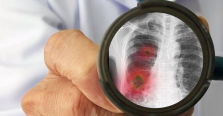 U Kantonu Sarajevo 32 nova slučaja zaraze koronavirusom