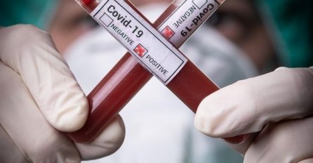 U RS-u 96 novozaraženih i jedan smrtni slučaj