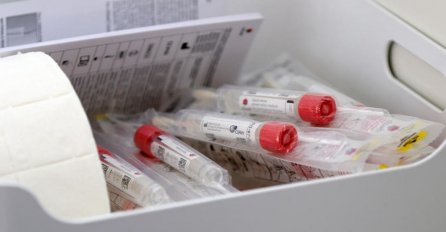 OGLASILA SE DIREKTORICA BOLNICE, UKOLIKO SE ŽELITE TESTIRATI NA KORONU TREBATE ZNATI OVO:  Jedna stvar može biti ogroman problem!