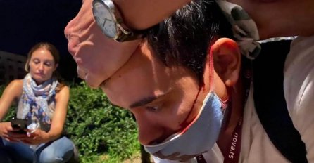 Huligani sa kapuljačama razbili glavu reporteru Nova.rs