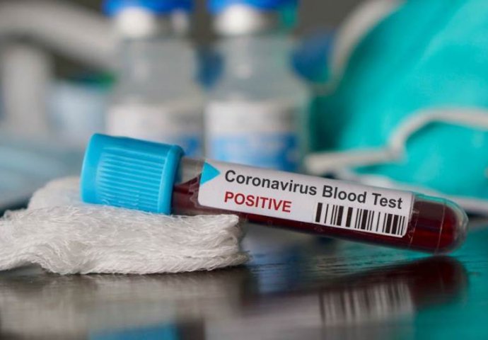 U BiH do danas zabilježen 15.801 slučaj zaraze koronavirusom