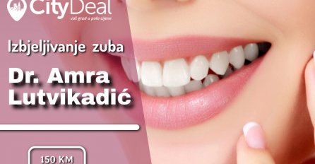 Platite SAMO 150 KM umjesto 600 KM za profesionalno izbjeljivanje zuba obje vilice!