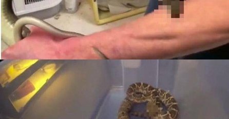 PUSTIO JE DA GA UGRIZU DVIJE NAJOTROVNIJE ZMIJE NA SVIJETU: Nećete vjerovati kad vidite ŠTA MU SE DESILO SA RUKAMA!