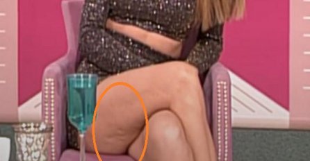   IPAK NISU SAVRŠENE: Pjevačica pokazala noge pune celulita NIKADA NE BISTE REKLI DA JE TO ONA