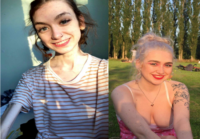 ŠOKIRALA JAVNOST: Djevojka objavila sliku prije i poslije anoreksije SVAKA TINEJDŽERKA BI OVO TREBALA VIDJETI 