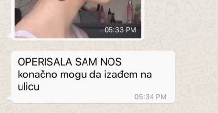 TETKA IZ NJEMAČKE MI JE POSLALA PARE DA OPERIŠEM NOS: Kad sam joj poslala sliku VRISNULA JE OD ŠOKA, NE VJERUJE DA SAM OVO JA (FOTO)