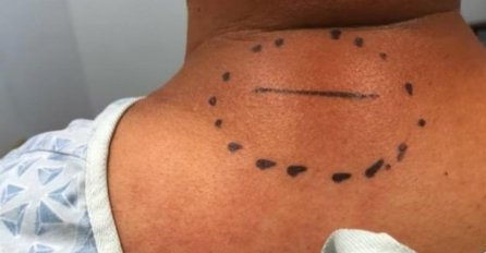 IMALA JE OVAKVU KRVGU NA LEĐIMA, OPREZ AKO JE NAPIPATE: Ona je otišla kod doktora, EVO ŠTA SU JOJ OTKRILI 