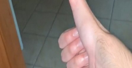 DOKTORI OSTALI U ČUDU: Momak sve zaprepastio dužinom palca 'Samo je rastao i rastao', a šta tek sve s njim radi (VIDEO) 