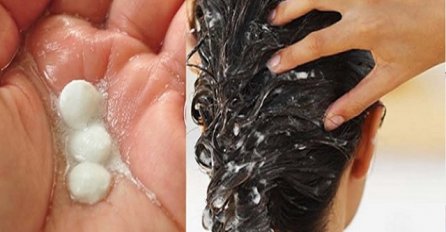 ZA OVO JOŠ NISTE ČULI: Aspirin će vratiti vašu kosu u život EVO ŠTA TREBATE URADITI