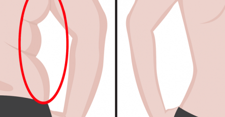 POTPUNO PRIRODNO: Uklonite salo sa leđa i ispod ruku sa ova brzinska četiri trika! Hiljade ljudi prezadovoljni ovom metodom!