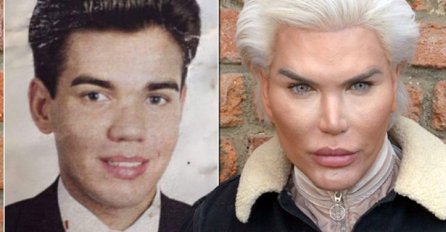 Od sebe napravio nakazu: Imao je ukupno 100 plastičnih operacija kako bi izgledao ovako! (FOTO)