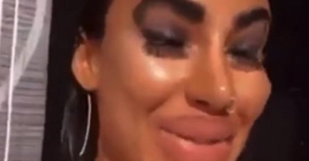 ONA IMA NAJVEĆE SILIKONSKE USNE NA ČITAVOM BALAKNU: Starleta svojim slikama šokira Instagram svaki dan