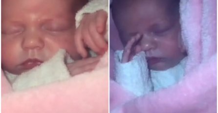 PRVOG DANA KAD SAM SE RODILA tetka je primijetila nešto čudno S MOJIM PRSTIMA: Uslijedila je operacija, a danas IZGLEDAJU OVAKO (FOTO)