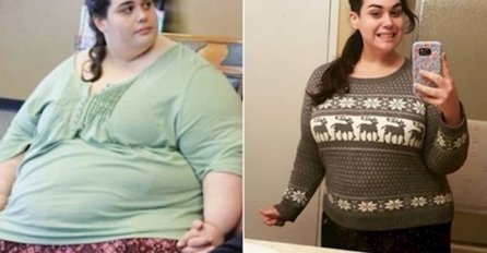 IMALA JE 24 GODINE I 300 KILA, NIJE MOGLA SAMA IĆI U WC: A onda je isisala SVO SALO, TRANSFORMACIJA STOLJEĆA! BOMBETINA (FOTO)