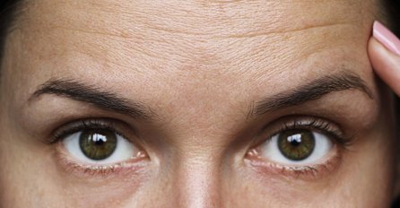 UPOZORENJE NAUČNIKA: Bore na čelu ukazuju na rizik od ove bolesti!