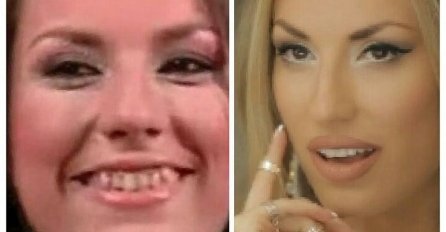 EVO ŠTA SU POZNATI RADILI SA ZUBIMA, ovako su izgledali prije nego su postali poznati: ČEKAJTE DA VIDITE PRIRODNE ZUBE CECE RAŽNATOVIĆ! NEPREPOZNATLJIVA