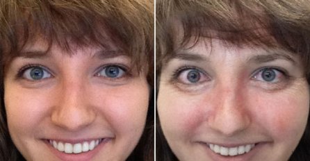 AKO OSTAVITE CIGARETE OVO ĆE VAM SE DESITI SA PLUĆIMA I ZUBIMA: Potrebne su samo 2 nedjelje!