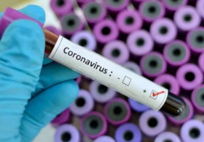 Meksiko prijavio prvog pacijenta zaraženog covidom- 19 i gripom A (H1N1)