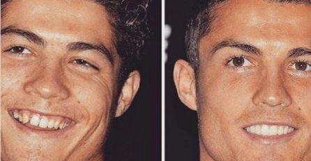 BILI SU RUŽNI I SIROMAŠNI, A ONDA SU SE OBOGATILI I TRANSFORMISALI: Kritične slike poznatih PRIJE OPERACIJA, br.10 će vas PREPASTI