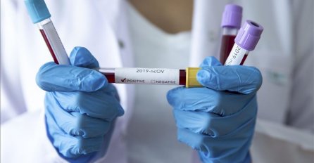 U Sarajevu preminula studentkinja zaražena virusom korona