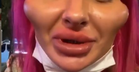 OTIŠLA JE KOD PLASTIČNOG HIRURGA I UNAKAZILA SE: A evo kako je NEKAD IZGLEDALA, ŠOK SLIKA