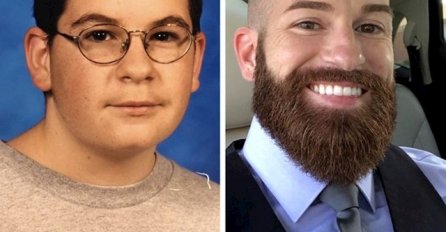 10 SLIKA KOJE POKAZUJU KAKO SU SE LJUDI POTPUNO TRANSFORMISALI: Kad vidite broj 7, TRLJAT ĆETE OČI OD ŠOKA