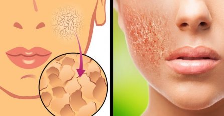 Ako tokom tuširanja PERETE I LICE pravite VELIKU GREŠKU posebno u OVOM SLUČAJU! EVO I ZAŠTO